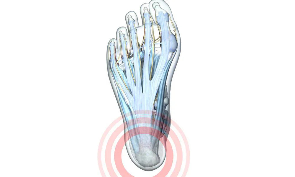 Heel Pain - Causes, Diagnosis, Symptoms & Treatment