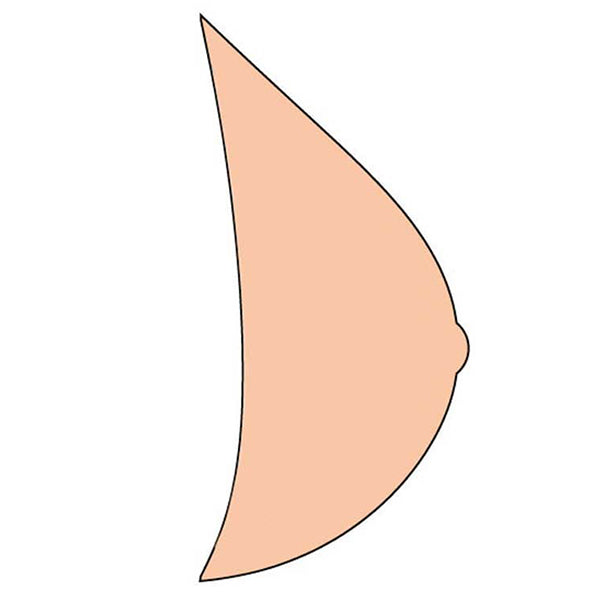 Essential Light 2S Breast Form