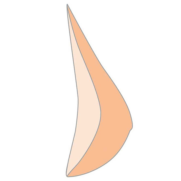 Natura 1S Breast Form