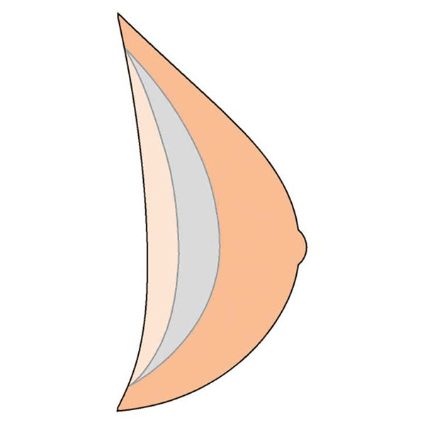 Natura 3S Breast Form