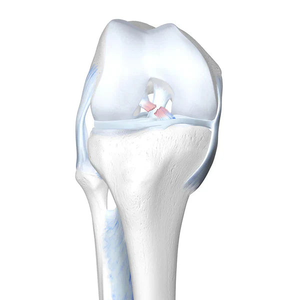 Patellar Tendonitis (Jumper's/Runner's Knee)