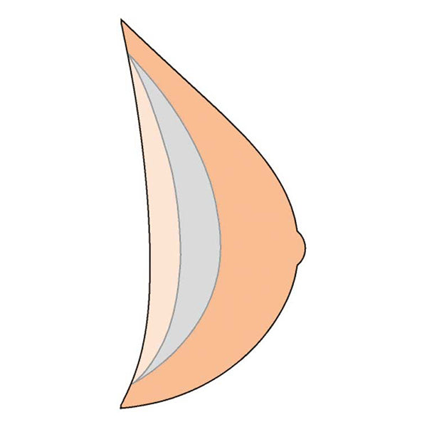Natura Xtra Light 2SN Breast Form